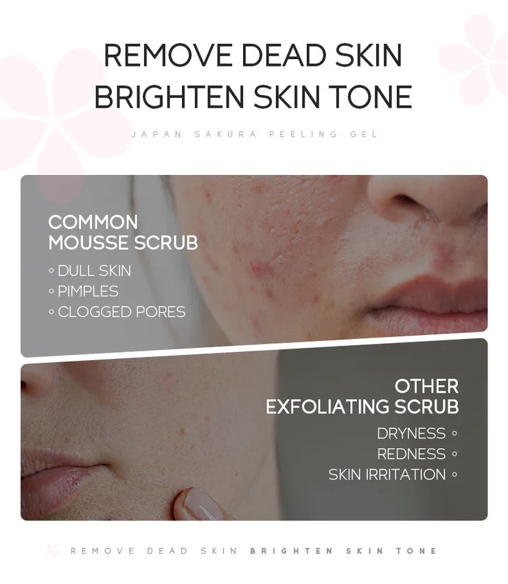 LAIKOU Sakura Moisturizing Facial Cleanser Peeling Gel Deep Cleansing Remove Dead Face Wash Skin Care