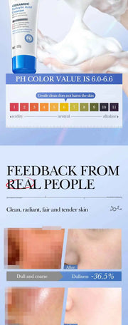 Salicylic Acid Cleansing Facial Cleanser Oil Control Anti-Acne Skin Care Whitening Cleanser Gentle Mild Facial Cleanser
