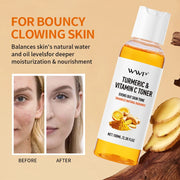 Turmeric Vitamin C Toner-Turmeric Antioxidant Refreshing & Moisturizing,Brightens & Softens Face Care Toner for All Skin Types