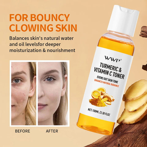 Turmeric Vitamin C Toner-Turmeric Antioxidant Refreshing & Moisturizing,Brightens & Softens Face Care Toner for All Skin Types