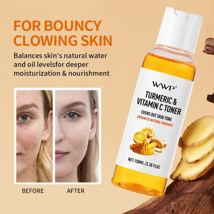 Turmeric Vitamin C Toner-Turmeric Antioxidant Refreshing & Moisturizing,Brightens & Softens Face Care Toner for All Skin Types