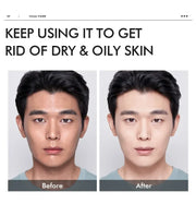LAIKOU Men Moisturizer Toner Hydrating Improving Dry Oil Control Face Care Refreshing Rejuvenate Korean Skin Care Product 100ml
