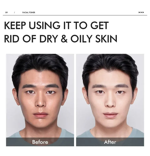 LAIKOU Men Moisturizer Toner Hydrating Improving Dry Oil Control Face Care Refreshing Rejuvenate Korean Skin Care Product 100ml
