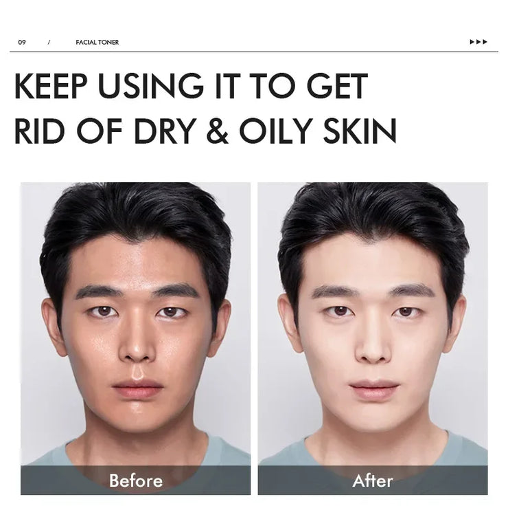 LAIKOU Men Moisturizer Toner Hydrating Improving Dry Oil Control Face Care Refreshing Rejuvenate Korean Skin Care Product 100ml