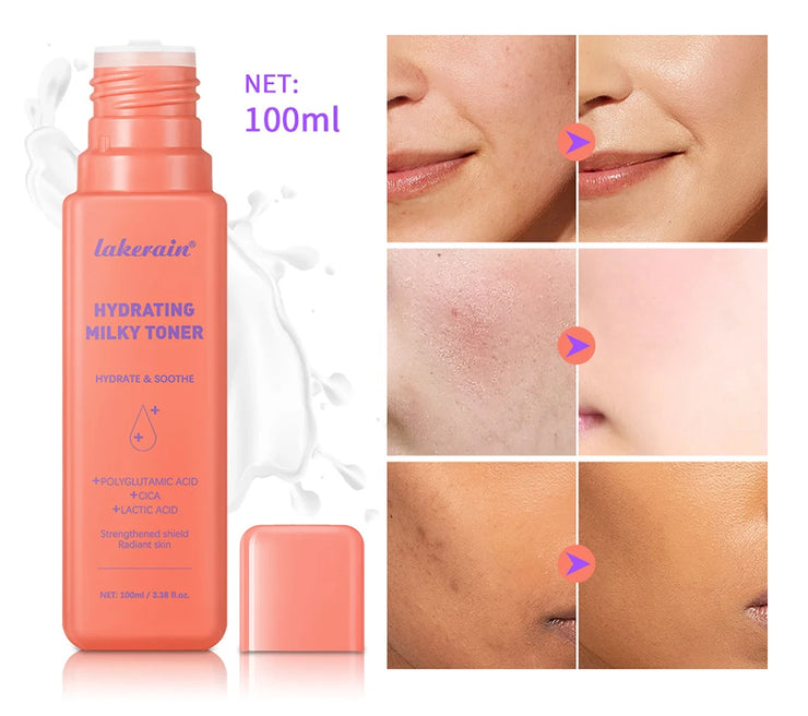 Hydrating Milky Toner Repair Skin Ultra Hydrating Toner for Face Soothes Skin Moisture Reduces Redness Barrier Skincare